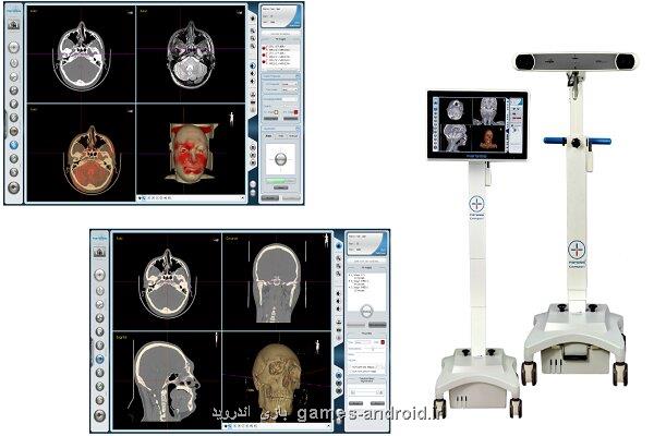 موفقیت در جراحی های خطرناک با تولید سامانه راهبری جراحی